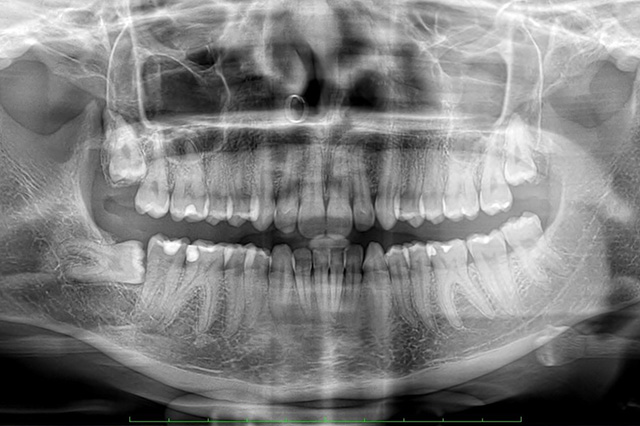 Chirurgia Orale Studio Dentistico Dottori Strappa Chirurgia Orale Studio Dentistico Dottori Strappa